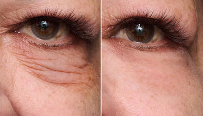One® Instant Eye Tightener