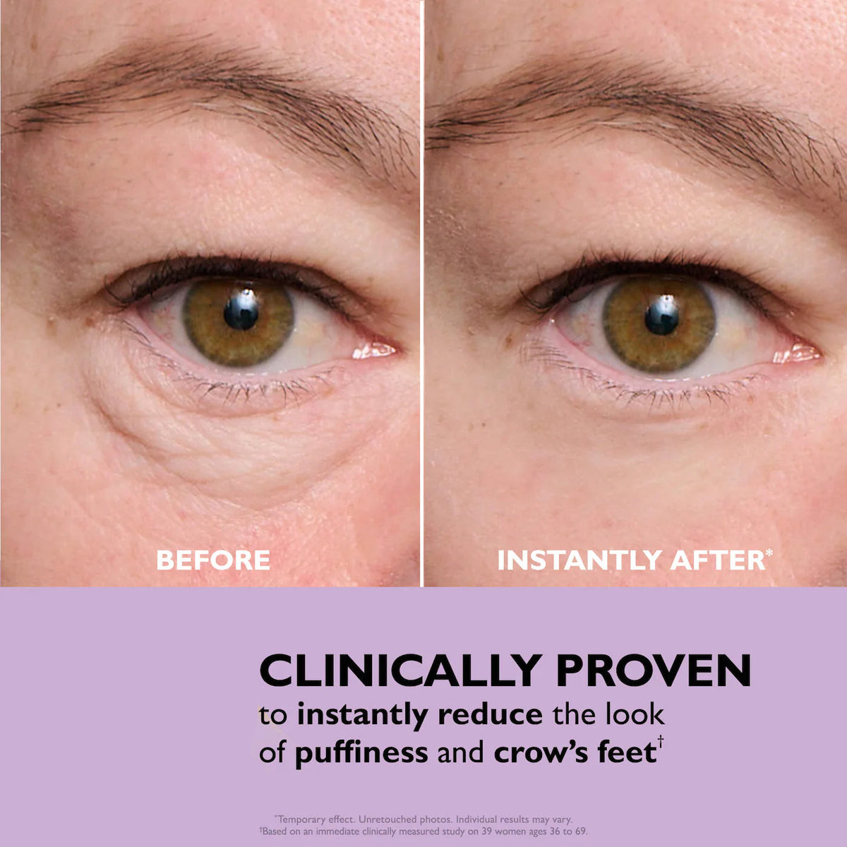 One® Instant Eye Tightener